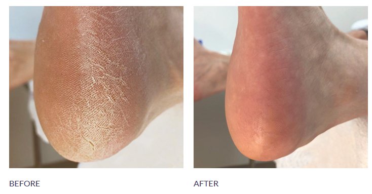 FOOT CARE COMBO - Imagen 3